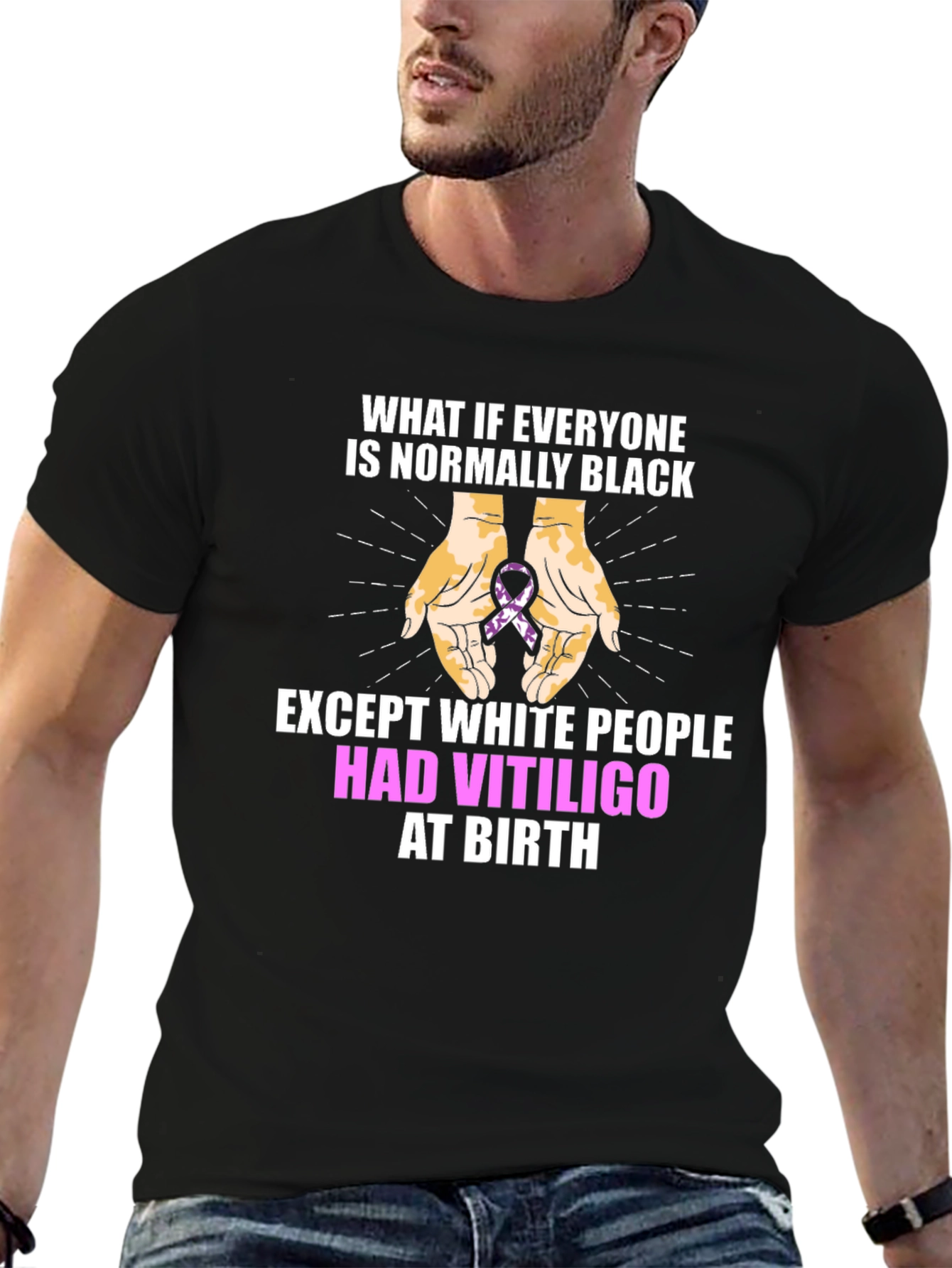 Vitiligo Awareness T-Shirt - Equality Design
