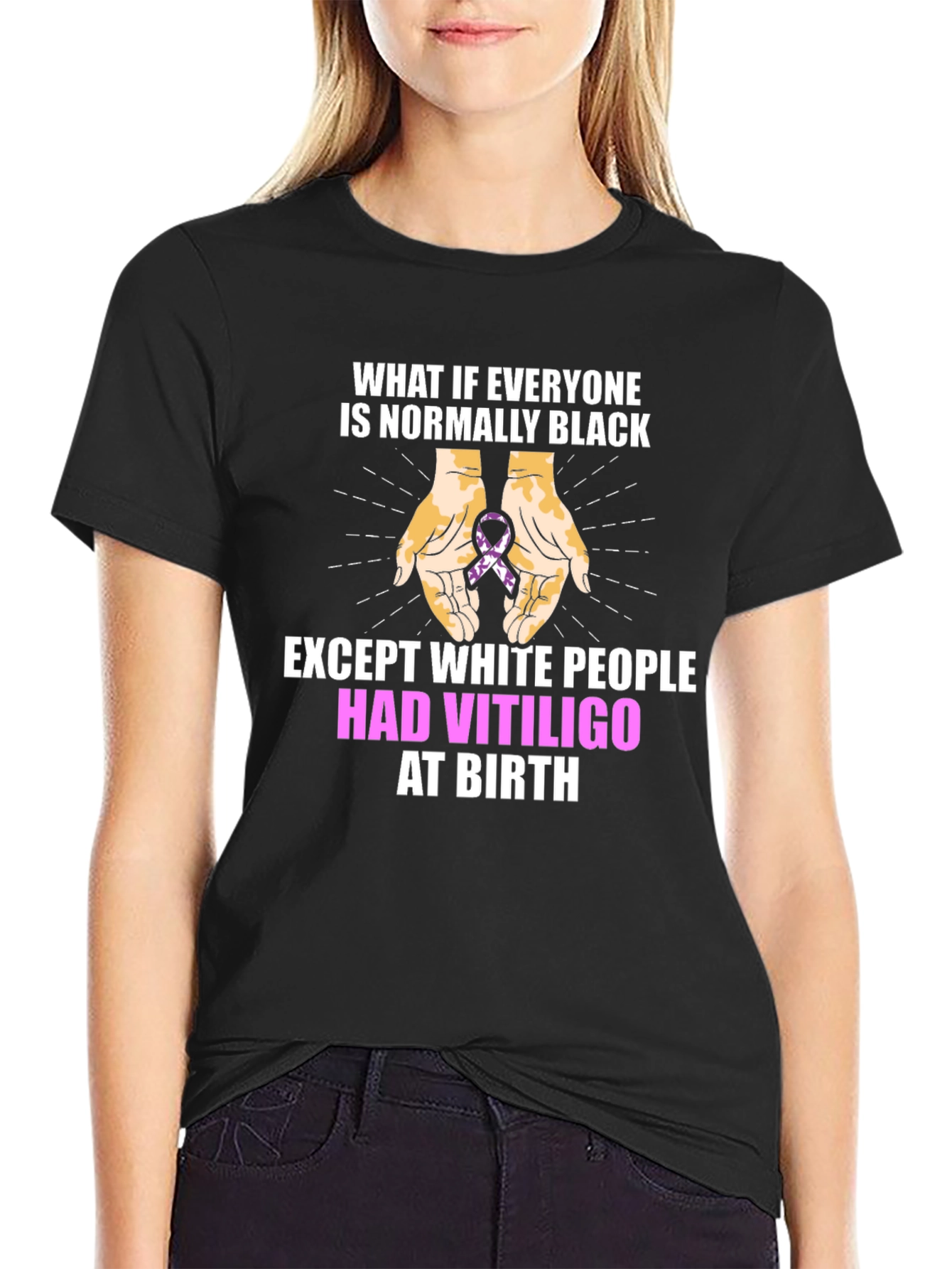Vitiligo Awareness T-Shirt - Equality Design