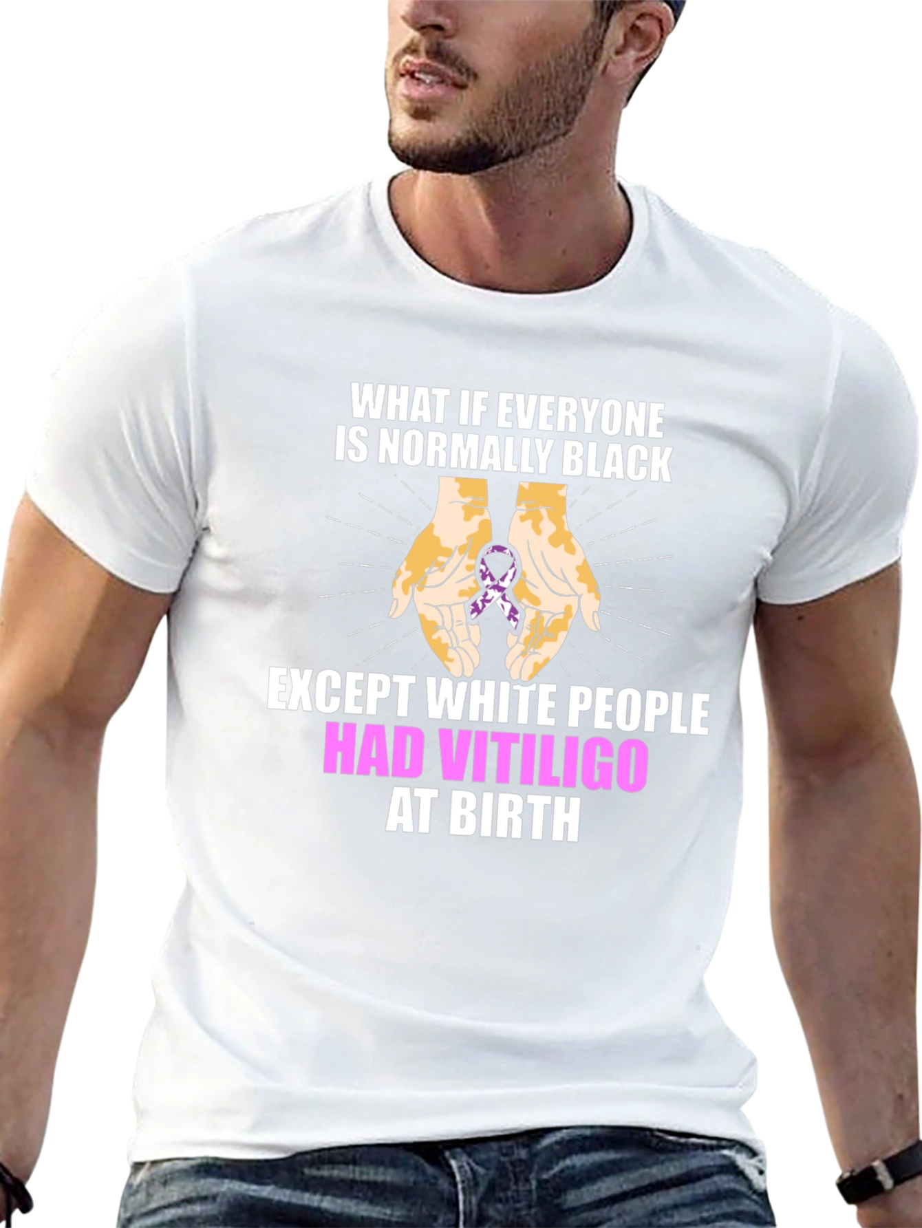 Vitiligo Awareness T-Shirt - Equality Design